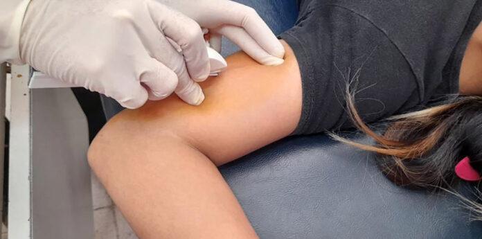 Implantes Subdérmicos